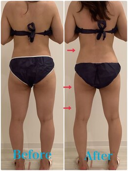 スペチアーレ 夙川/要らない脂肪とサヨナラできる!