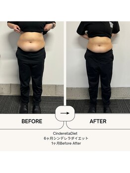 オーシャン整骨院(OCEAN整骨院)/６ヶ月コース