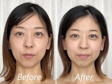 ドクターボディ 新宿店(Dr.Body)/【口歪み/歯の突出/面長　30代】