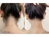うなじハイスピード脱毛☆￥4,800→¥2,500
