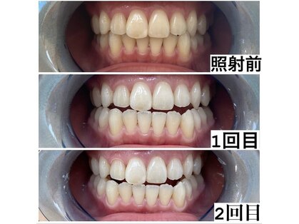 ヴィシア(VIXIA)の写真
