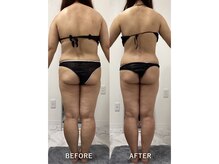 ナルシス/【痩身】5ヶ月の変化です★