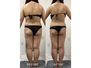 ナルシス/【痩身】5ヶ月の変化です★