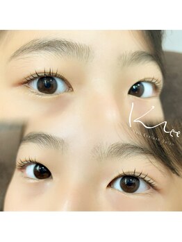 クレー(Klee)/ラッシュリフト