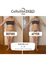 メリッサ(Melissa)/【痩身】４回でスッキリ♪