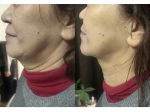 サロン バイ デイジー(SALON by DAISY)の雰囲気（RFと光の最強フォト１回でもしっかり効果実感していただけます。）