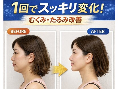 ドクターアーチ 神戸三宮 小顔矯正･整体サロン(Dr.ARCH)の写真