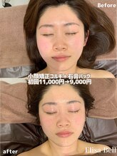 エリーザベル(Elisa Bell)/小顔矯正コルギ