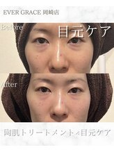 リラベル(Lira Belle)/疲れ目にハンドと機械で徹底ケア