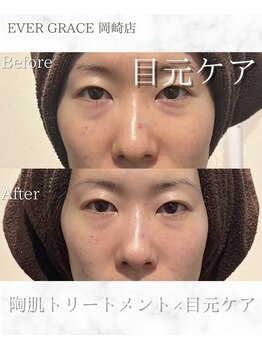 リラベル(Lira Belle)/疲れ目にハンドと機械で徹底ケア