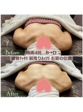 サムサラ(SamSara)/BeforeAfter/バストボリューム