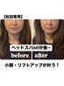 ～松田専用～小顔/リフトアップが叶う★極上ドライヘッド スパ  [女性限定]