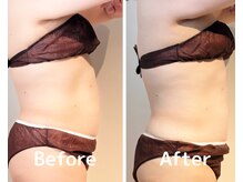 美活ラボ(美活LABO)/ビフォーアフター