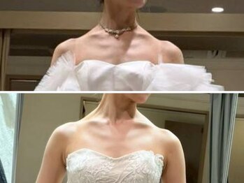 エントテ(en to Te)/ドレスが似合う美しいデコルテに