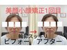 【美顔、小顔調整 】    ¥5500⇒ 4900
