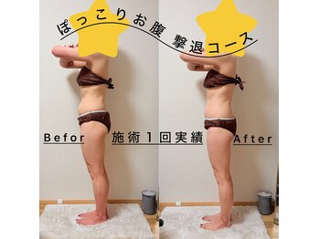 ラディアボディ四十瀬