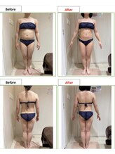 エステティック レイビス 銀座店(RAYVIS)/