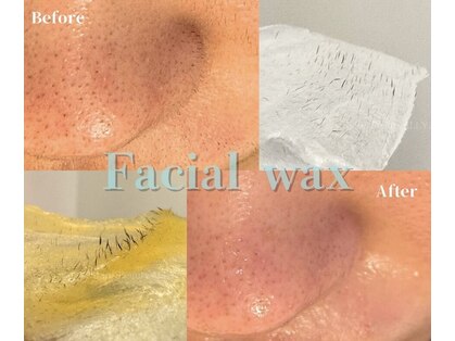 アリー(ALLY)の写真