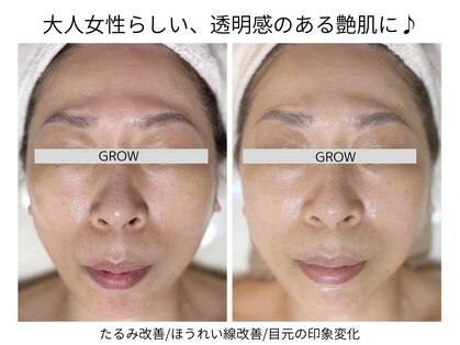 グロウ バイ フェイシャルデザイン アンド アイ(GROW)の写真