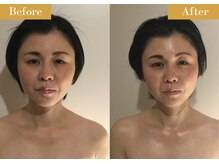 モモスパ(MOMOspa.)/頭蓋骨小顔矯正ビフォアフター