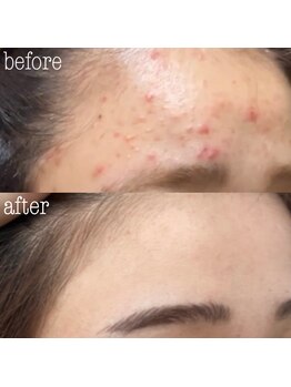 ラヴァン(LaVan)/モナリスターターセット