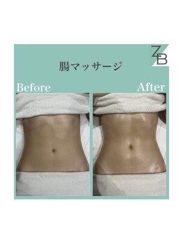ザラハビューティー(ZARAHA Beauty)/ZARAHA式 腸セラピー