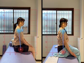 松戸駅前鍼灸院 整骨院の写真/“技術/価格/通いやすさ◎”可動域を広げ巡りもUP!!慢性腰痛/反り腰に【お身体ト-タルケア】6000円→1980円