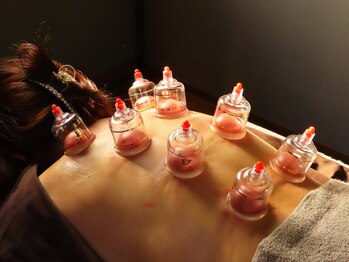 生慶堂整体院 浅草/吸玉