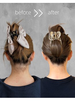 ヒダマリ 新屋敷店(Hidamari)/うなじ&背中脱毛8回目