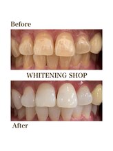 ホワイトニングショップ 今出川店(WHITENING SHOP)/