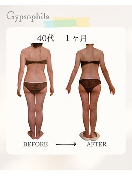 ジプソフィラ(Gypsophila)/痩身ビフォーアフター