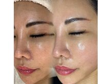 サロンケア×ホームケアの両方から美肌づくりをサポート♪