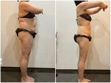 美容整体ウェリナ あま甚目寺院/小顔矯正/骨盤矯正/美脚サロン