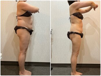 美容整体ウェリナ あま甚目寺院/小顔矯正/骨盤矯正/美脚サロン