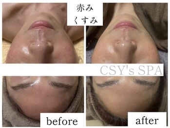 ヘルスアンドビューティー シーズスパ(CSY's SPA)/ダクトピール