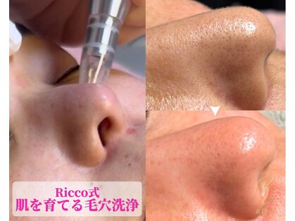 リコ(Ricco)の写真