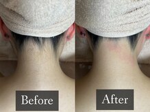 ベルフィーヌ 恵比寿店(BELFINE)/誰もが憧れる美しい首元へ