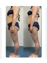 シェリスパ(Cheri Spa)/モニター様募集中です！