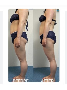 シェリスパ(Cheri Spa)/モニター様募集中です！