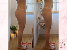 サロンドモアロ(Salon de Moaro)/Before/After