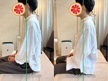 グレフル鍼灸接骨院 整体院 心斎橋/整体/肩こり/マッサージ/腰痛