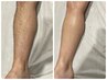 【ツルツル美脚】足全部位★光脱毛