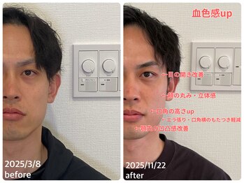 KTYフェイスジム 名古屋栄店(KTY FACE GYM)/男性様もご利用いただいてます！