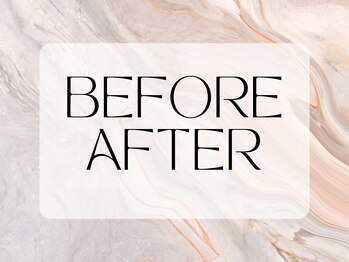 セルヴィノバ(CELL VI NOVA)/◇Before／After