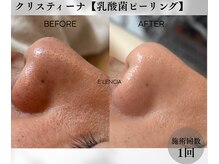エレンシア(E'lencia)の雰囲気（１回で変化実感！【毛穴撲滅】乳酸菌ピーリングで鎮静＋毛穴レス）