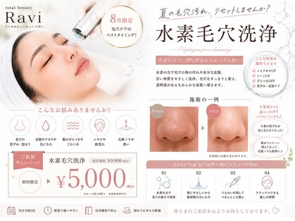 ラヴィ(Ravi)の写真