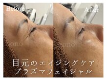 いごこちいい場所 ほのほの/新★プラズマフェイシャル