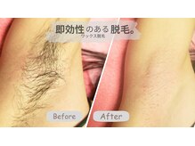 ワックス脱毛サロン ククナ(kukuNA)の雰囲気（その場でツルツル♪根元からスッキリ、触れたくなる肌へ）