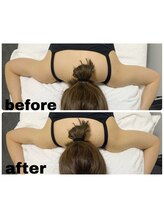 エクスクラメーションマーク(!!!)/ボディー二の腕