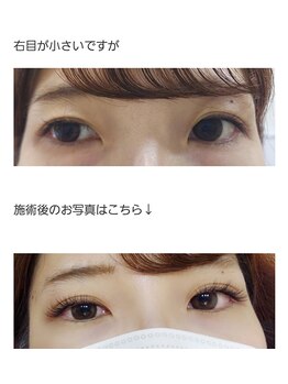 アロマスイーツ(AromaSweets)/パリエク/マツエク/パリジェンヌ